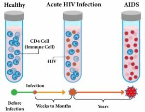 stages of HIV infection